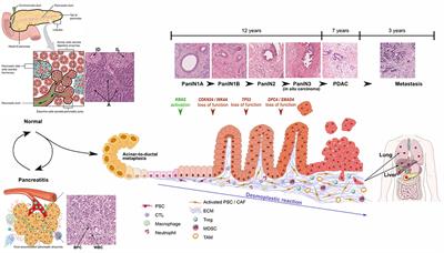 Stroma Involvement in Pancreatic Ductal Adenocarcinoma: An Overview Focusing on Extracellular Matrix Proteins